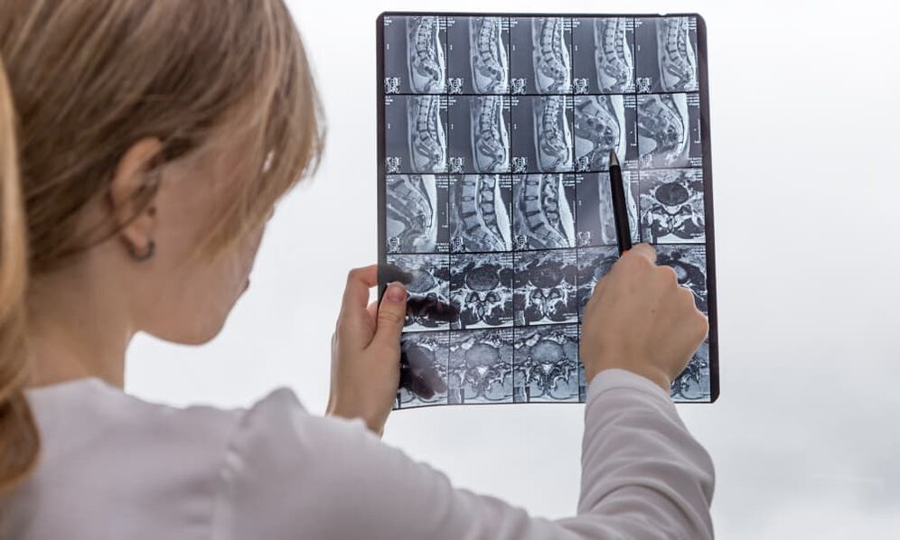 MRI will help the doctor identify osteochondrosis and prescribe treatment