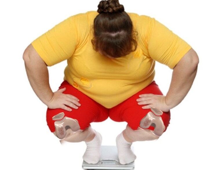 Among patients with osteoarthritis, the majority are overweight or obese